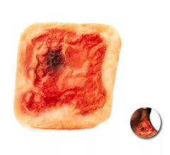 False adult reddish false scar