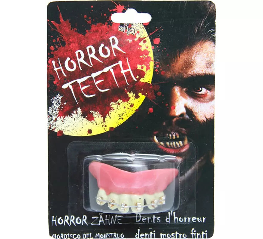 Dentadura con Brakets