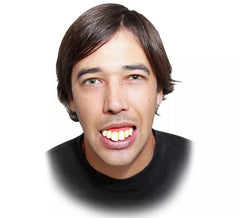 Denture with extra large teeth