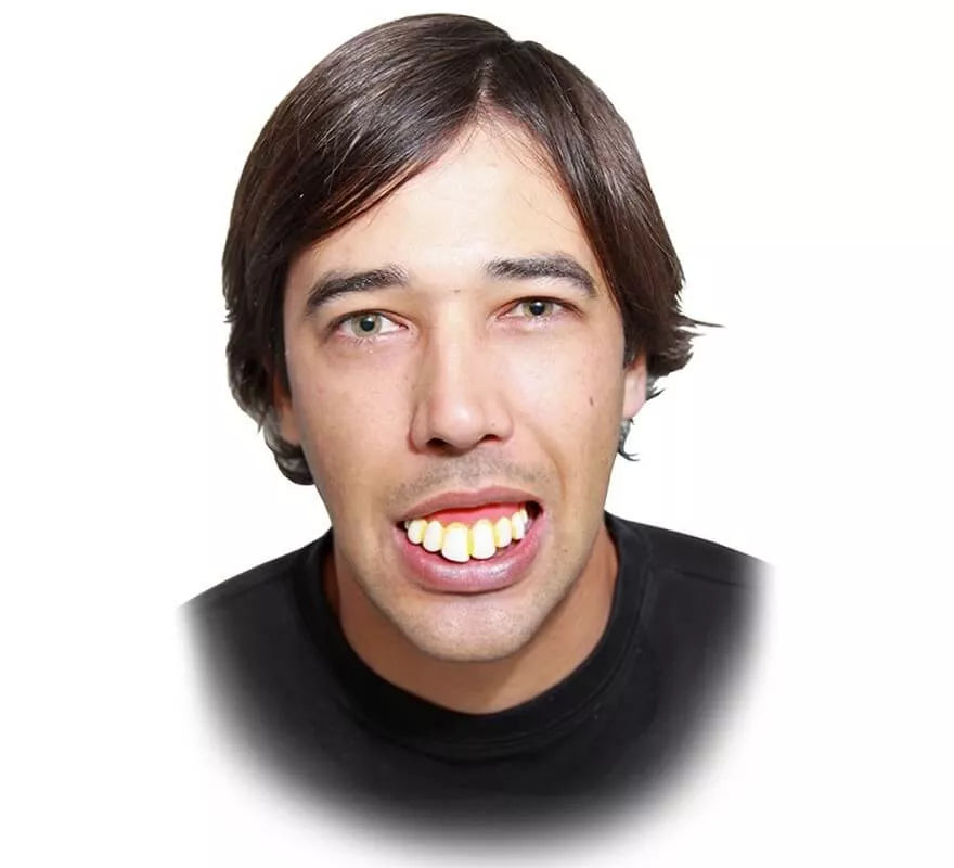 Translation missing: en.Dentadura con dientes extra grande